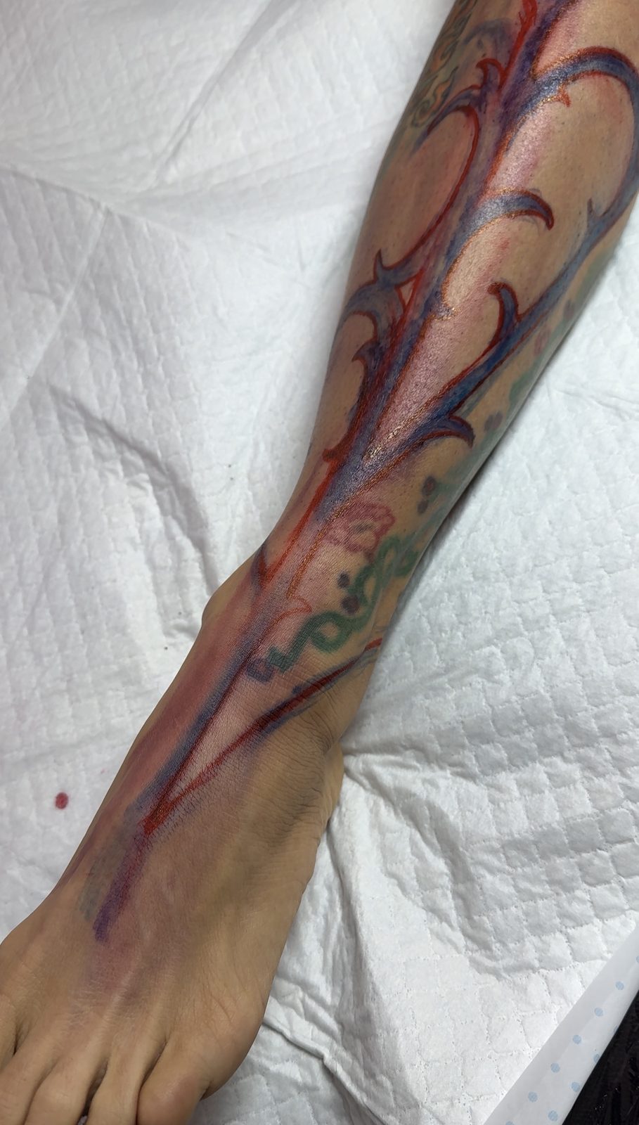 Freehand marker drawing over an old leg tattoo before a cover-up, by Si, Bristol